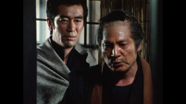 第14回 額の傷が見た!恐怖のあしたを